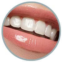 Porcelain Veneers Icon