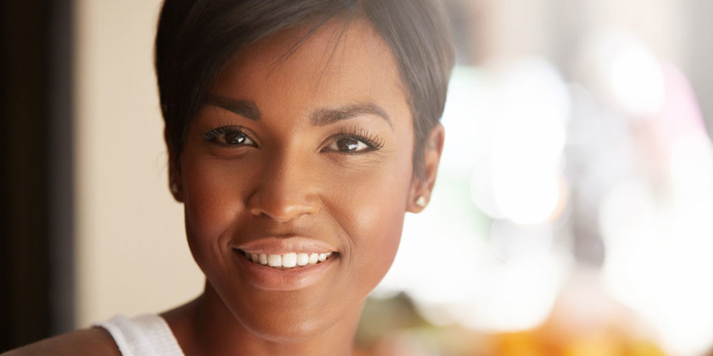 Smiling with Bonded Teeth